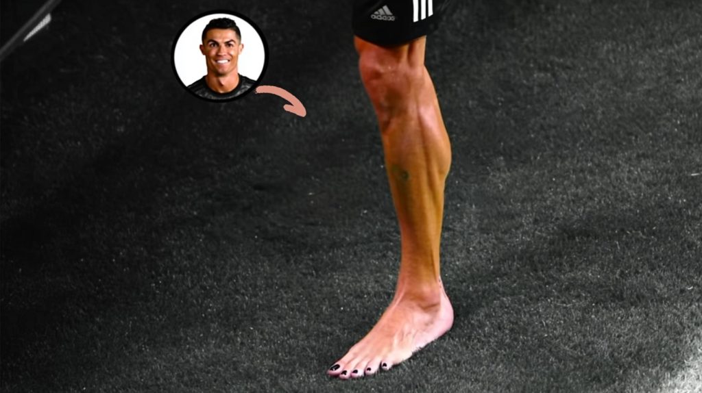 Ronaldo’s secret weapon: the science behind his black toenails ronaldo feet